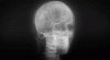 Skull X-ray.gif