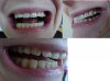 TeethReady.jpg