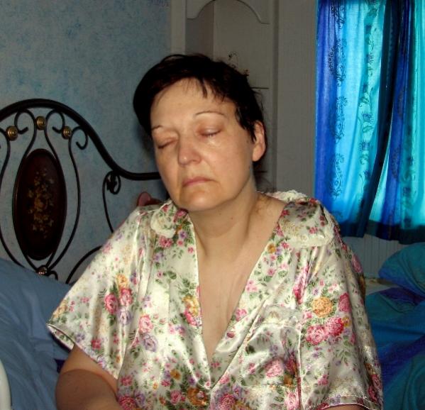I wanted to show you all just how I look when I&#039;m ill, this is me ..........but if you...